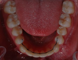 imagegen-11.jpg