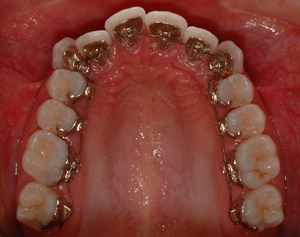 imagegen-8.jpg