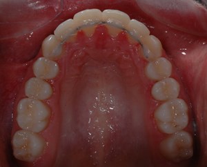 imagegen-9.jpg