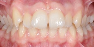 imagegen-1.jpg