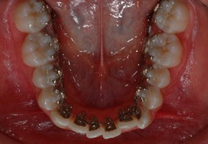 imagegen-10.jpg
