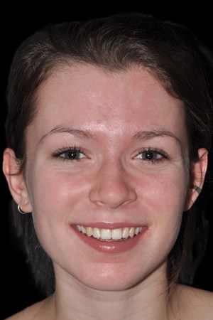 imagegen-2.jpg